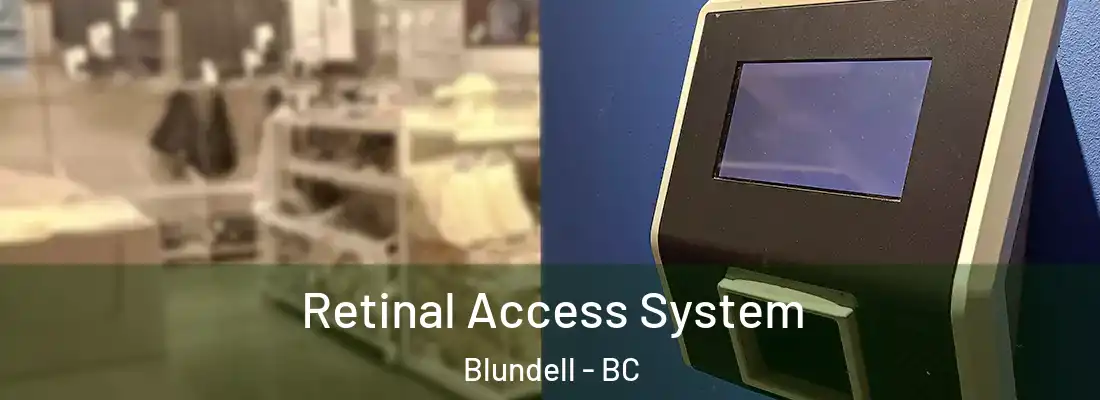  Retinal Access System Blundell - BC