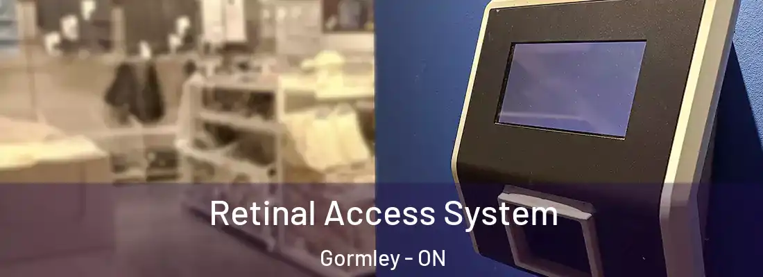  Retinal Access System Gormley - ON