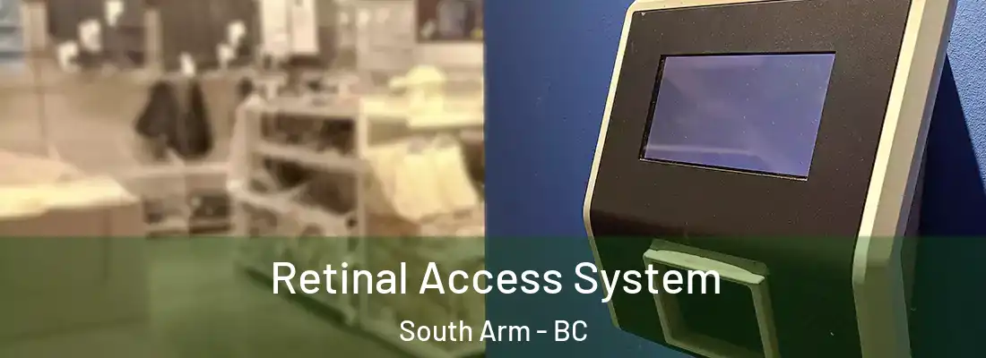  Retinal Access System South Arm - BC
